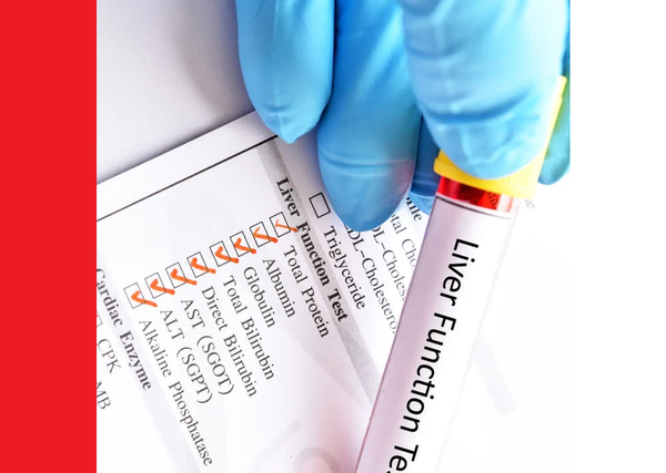 Understanding liver health: symptoms, laboratory tests and prevention ...