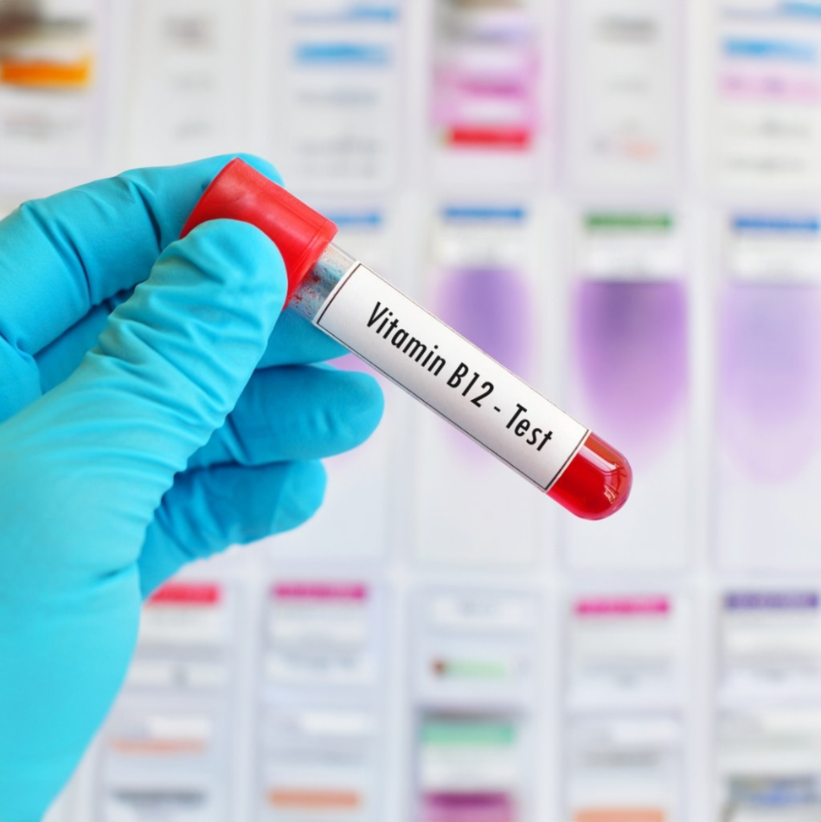 Vitamin B12 and Folic Acid