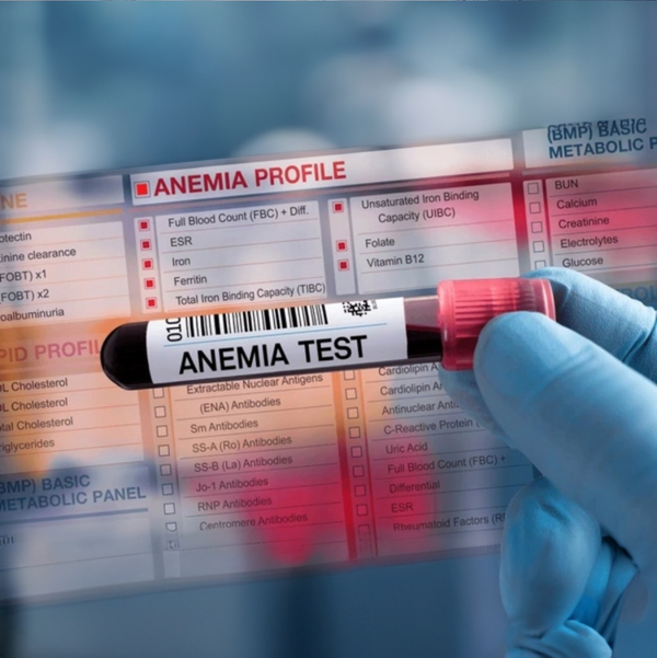 03057- Panel de Anemia