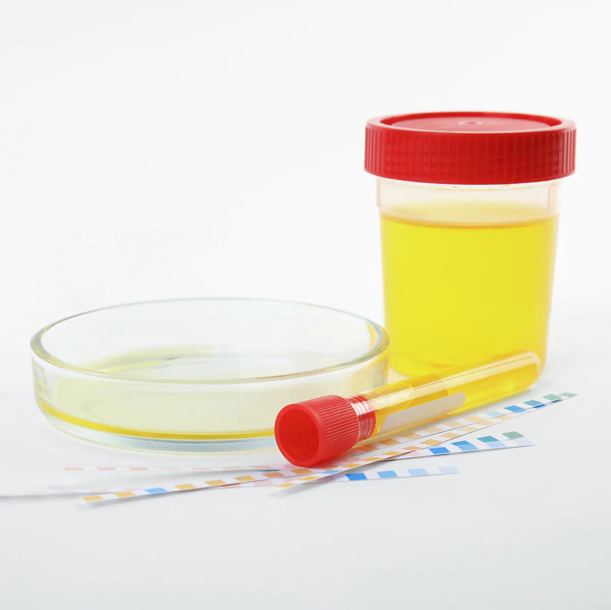 008847-Urine Culture